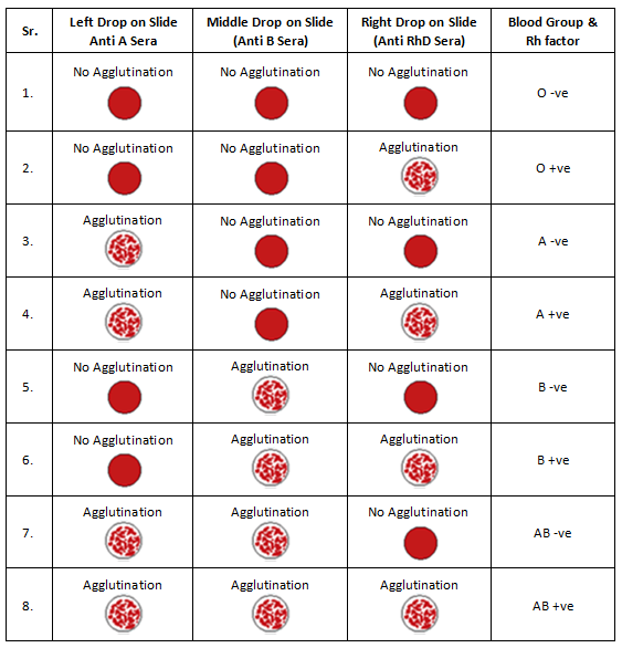 Clinical Method of Finding Blood Group & Rh Factor